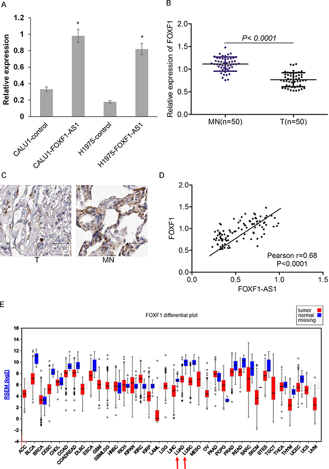 Loss of FOXF1-AS1 is correlated with downregulation of FOXF1 in lung cancer.