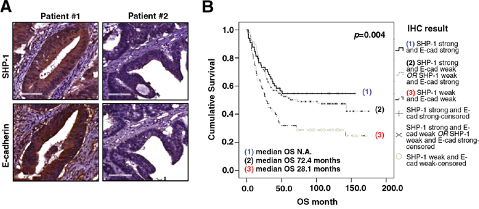 The expression of SHP-1 and E-cadherin correlates with overall survival of CRC patients.