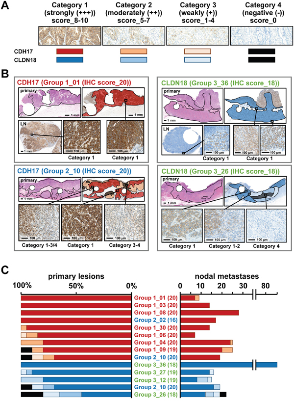 Whole section analysis of immunostaining of CDH17 and CLDN18.