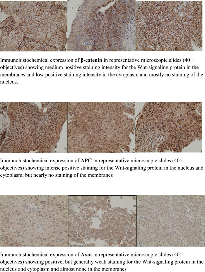 Microscopic slides of immunohistochemical staining of the Wnt-signaling proteins &#x3b2;-catenin, PC and axin.