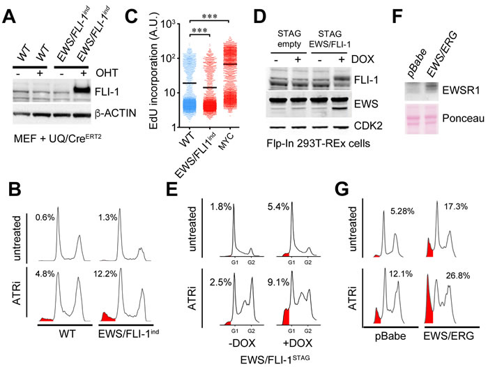 Expression of EWSR1 translocations sensitizes cells to ATRi.