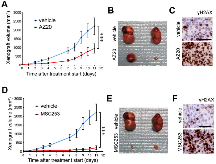 Efficacy of ATR inhibitors in ES xenografts as single agents.