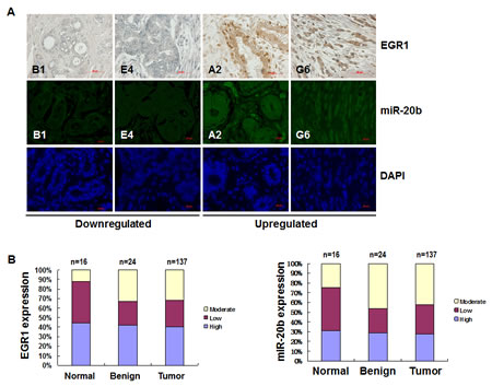 EGR1 expression is correlated with miR-20b expression in breast cancer tissues.