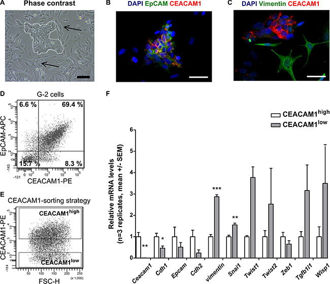 CEACAM1-expression