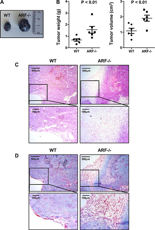 Increased tumor growth and fibrous capsule in B16F10-ARF&#x2212;/&#x2212; tumor xenografts.