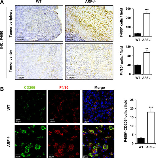 ARF deficiency enhances recruitment and activation of macrophages to acquire M2 phenotype.