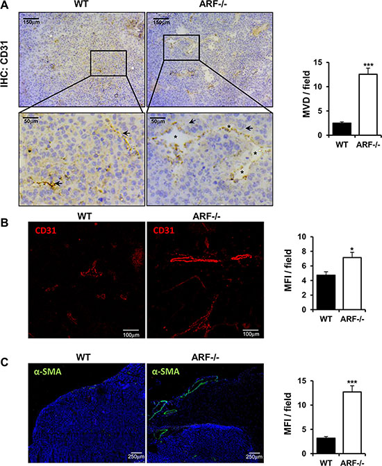 Tumor angiogenesis is increased in ARF&#x2212;/&#x2212; tumor xenografts.