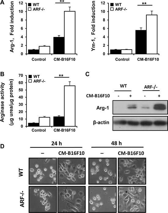 B16F10 cells educate ARF&#x2212;/&#x2212; macrophage towards a M2 phenotype.