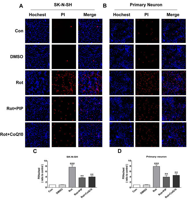 PIP reduces cell death rate in SK-N-SH cells and primary neurons treated with rotenone.