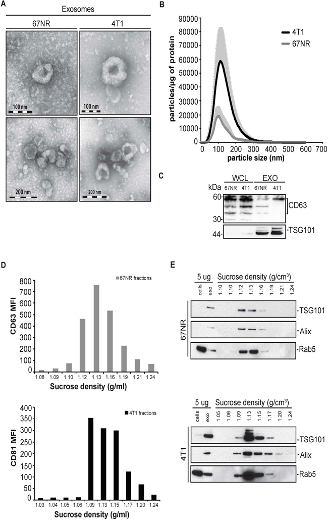 Characterization of extracellular vesicles secreted from non-metastatic mouse breast cancer cell line 67NR and metastatic mouse breast cancer cell line 4T1.