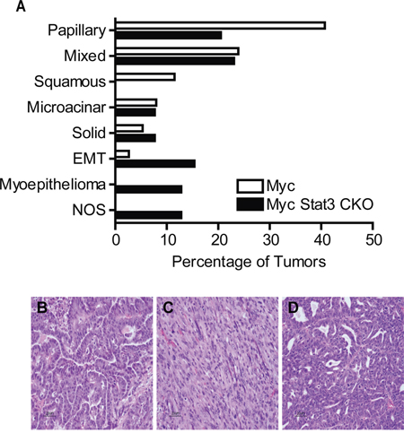 Loss of Stat3 alters tumor histology.
