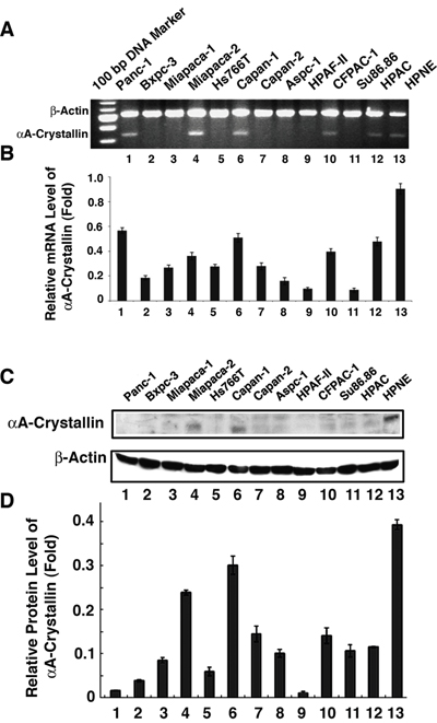 Detection of &#x03B1;A-crystallin mRNA and protein expression in pancreatic cancer cell lines.