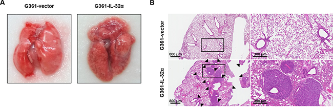 IL-32&#x03B1; expression affects in vivo lung metastasis.