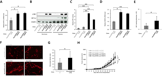 Figure 4. LY6E activated HIF-1, induced angiogenesis, and consequently accelerated tumor growth.