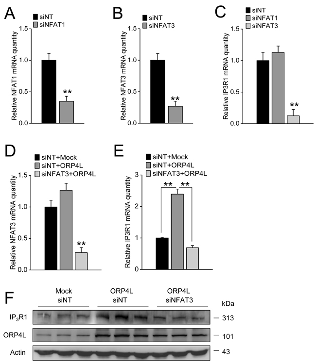 ORP4L maintains IP3R1 expression via regulating NFAT3.