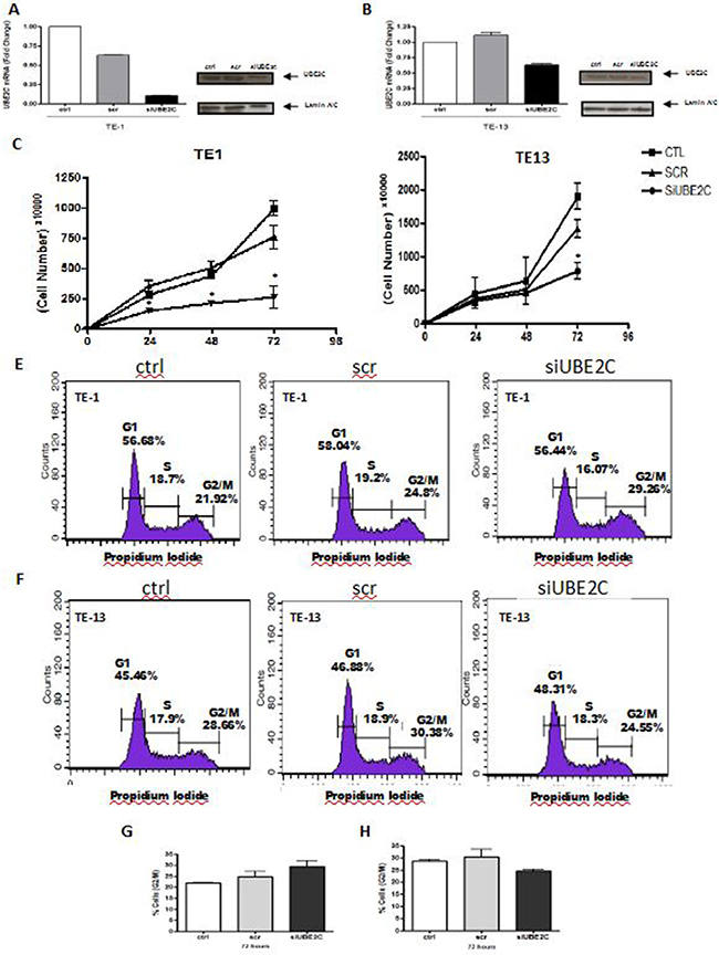 UBE2C silencing alters growth rates and cell cycle profile of ESCC cell lines.