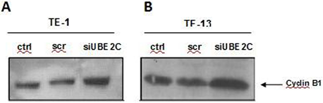 UBE2C silencing leads to upregulation of Cyclin B1 in ESCC cell lines.