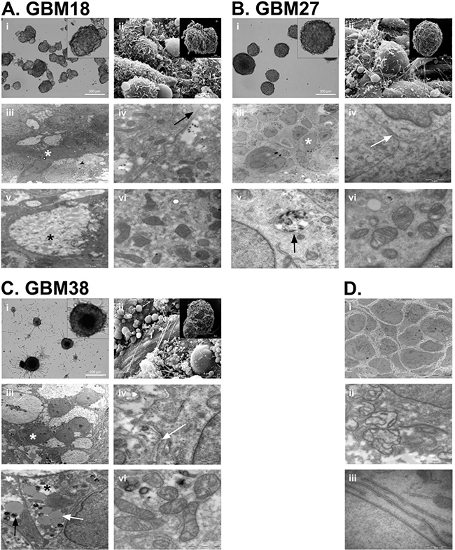 Neurosphere architecture and cell morphology analysis of GBM18, GBM27 and GBM38 CSC-enriched cultures.