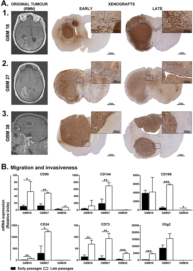 Brain dissemination patterns of early and late CSCs isolated from human samples.