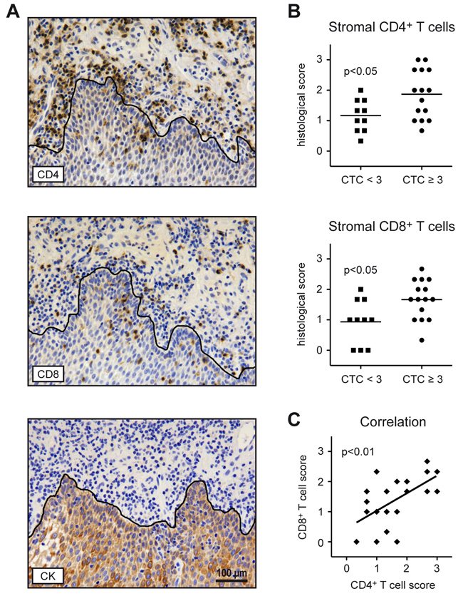 T cell infiltration in pre-treatment tumor material from HNSCC patients.