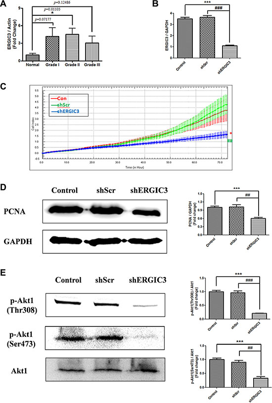 ERGIC3 expression in tumor tissues and effect of shERGIC3 downregulation.