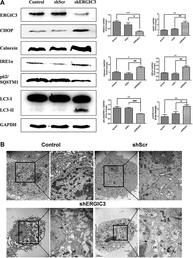 Suppression of ERGIC3 induces ER stress-induced autophagy in A549 cells.