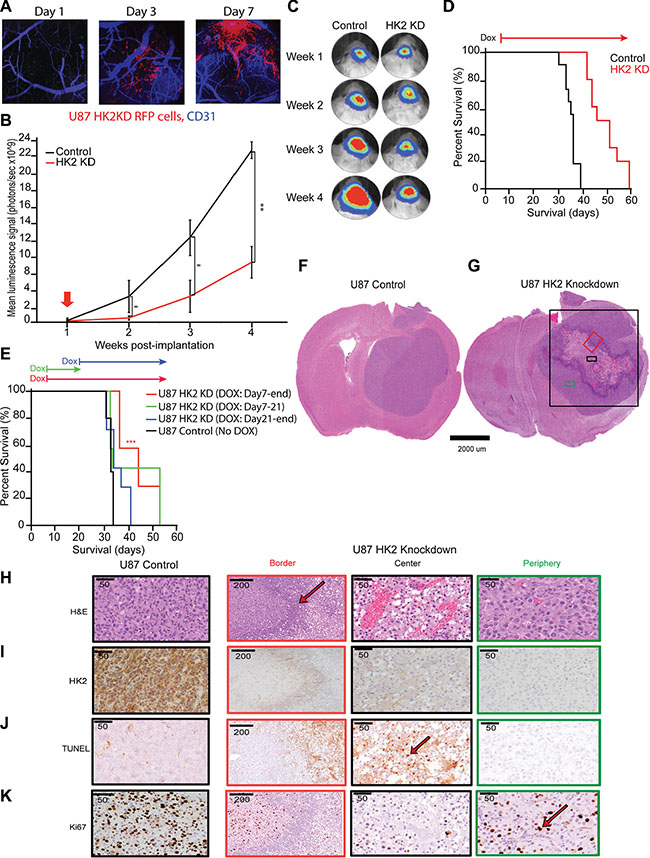 Loss of HK2 increases survival in GBM xenografts and is stage dependent.