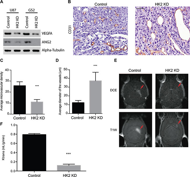 HK2 loss diminishes tumor vasculature in a GBM xenograft model.