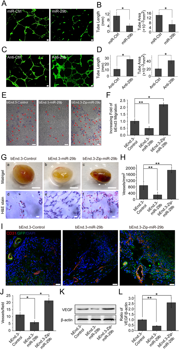 miR-29b inhibits angiogenesis