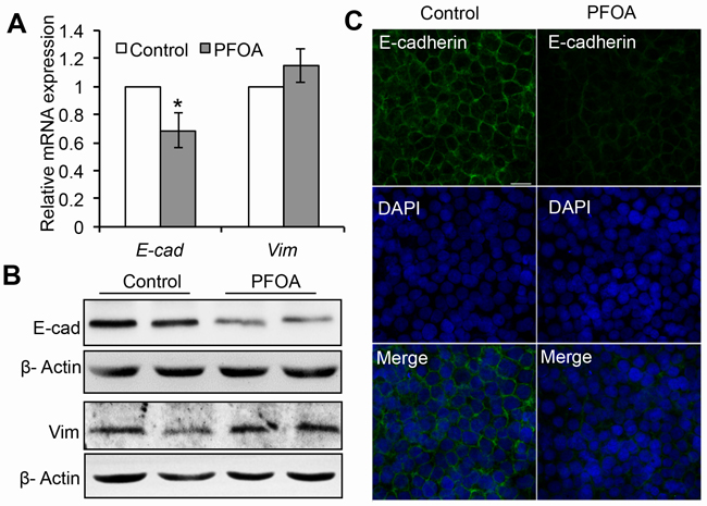 PFOA treatment induces down-regulation of E-cadherin expression in Ishikawa cells.