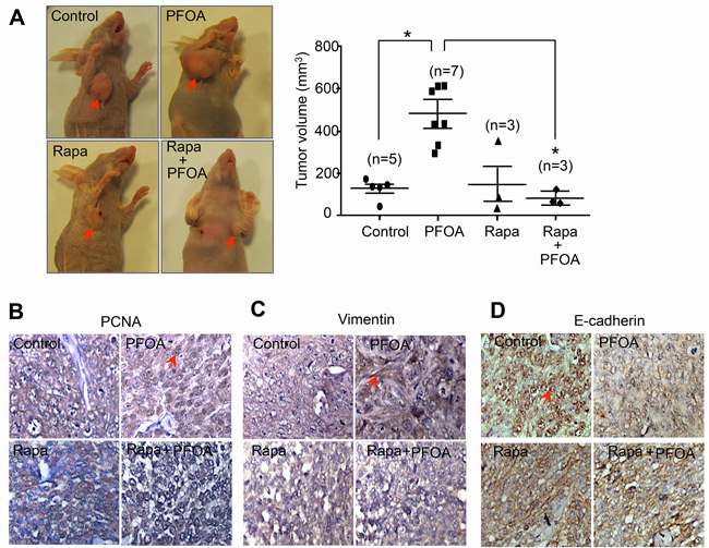 PFOA promotes tumorigenesis