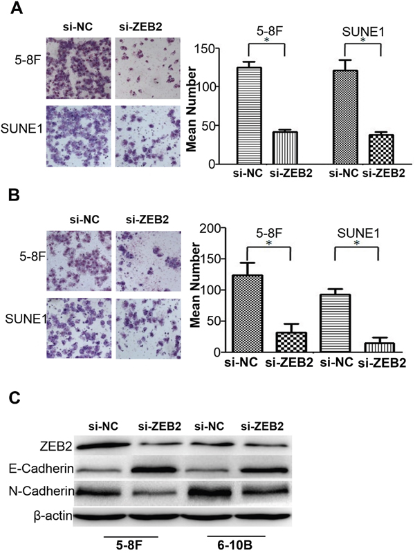 Knocking dwon ZEB2 suppresses cell migration and invasion by regulating EMT signals in NPC.