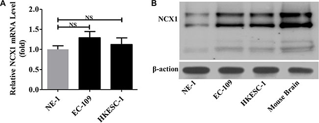 Expression levels of NCX1 in normal human esophageal epithelial cell line (NE-1) and human ESCC cell lines (EC-109 and HKESC-1).