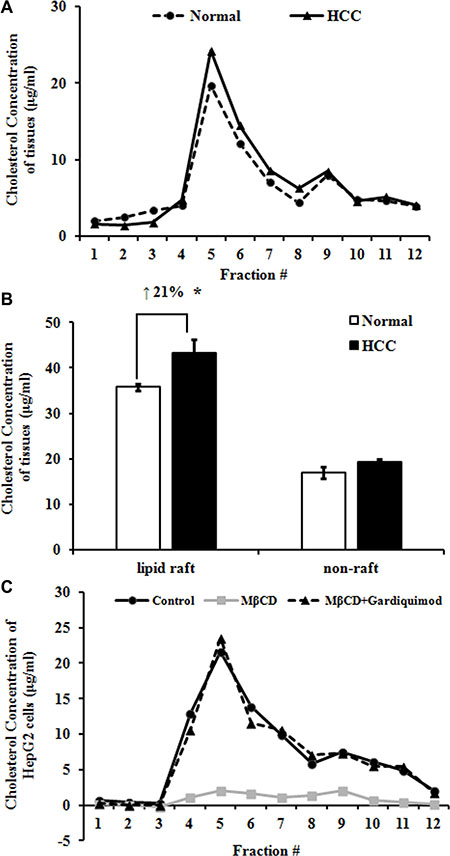 Increased cholesterol in lipid rafts of human HCC tissues and HepG2 cells.