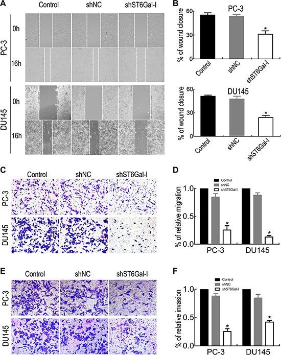 ST6Gal-I knockdown suppressed PCa cell migration and invasion.