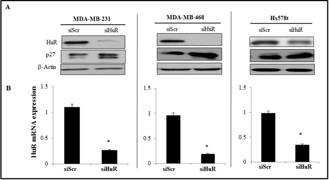 Effect of HuR silencing on the expression of HuR protein and mRNA.