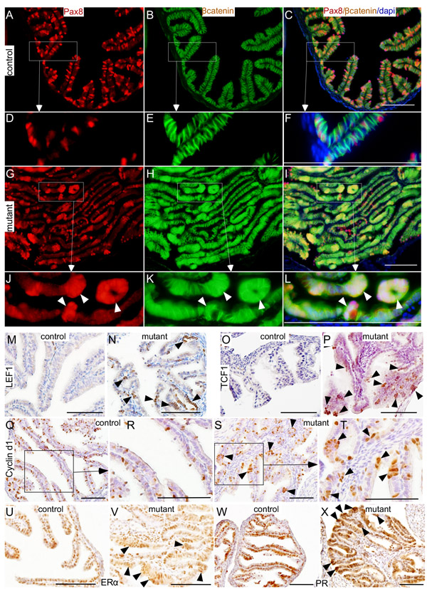 Histopathological analysis of abnormal changes in the mutant fallopian tube epithelium.