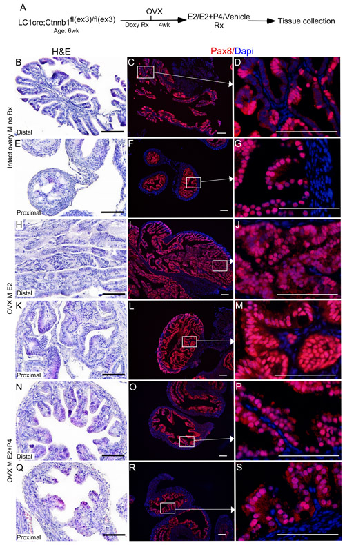Oestrogen promotes and progesterone suppresses the growth of precancerous lesions in the mutant fallopian tube epithelium.