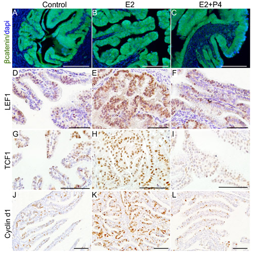 Ovarian hormones modulate Wnt/&#x3b2;catenin signalling to affect the growth of precancerous lesions.