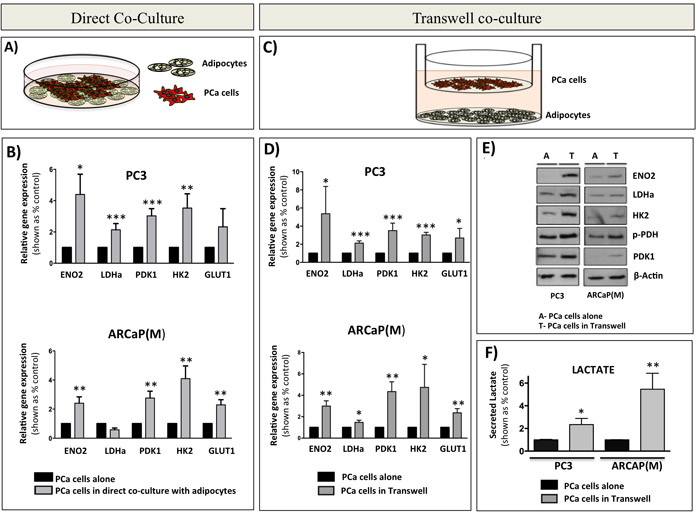 Bone marrow adipocytes enhance a glycolytic phenotype of prostate cancer cells in direct co-culture and in transwell co-culture