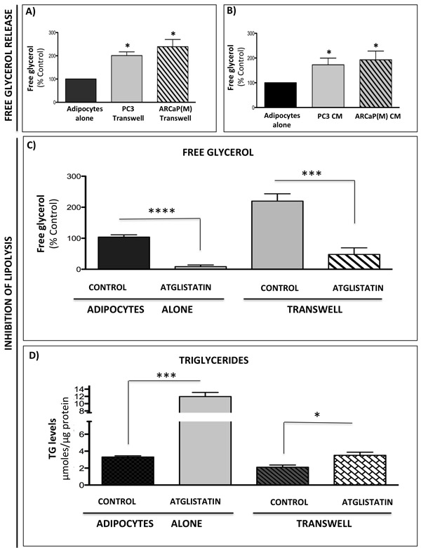 Prostate cancer cells stimulate lipolysis in bone marrow adipocytes.