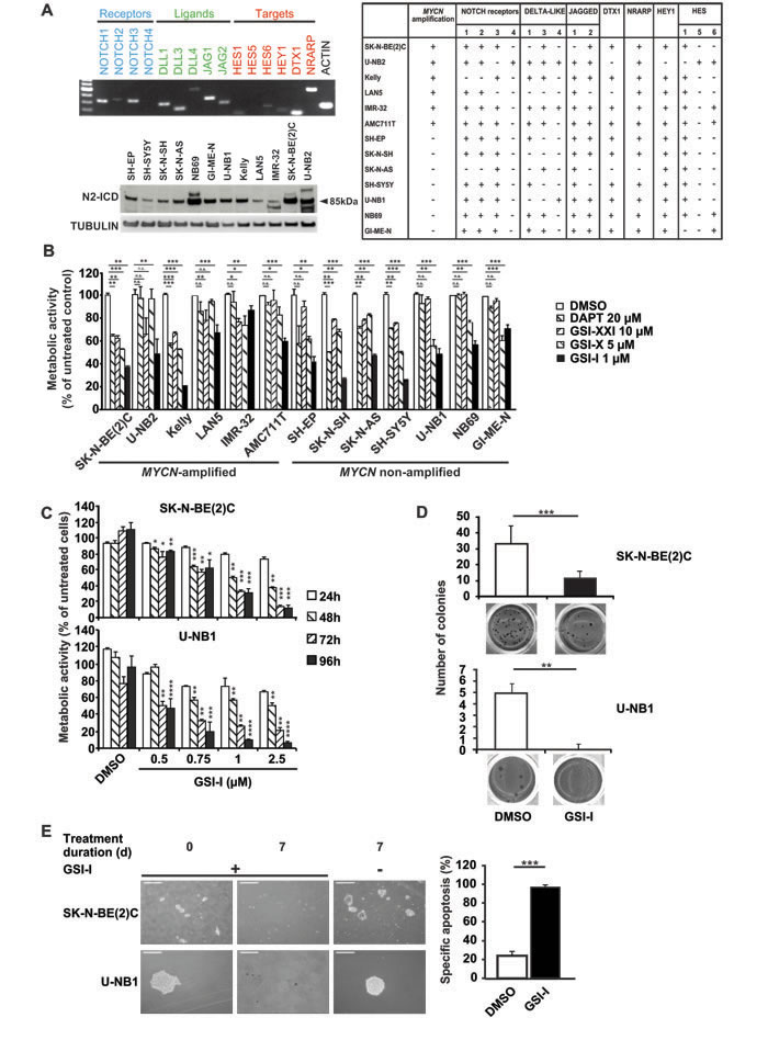 NOTCH signaling is active in human NB cells and inhibition of &#x3b3;-secretase
