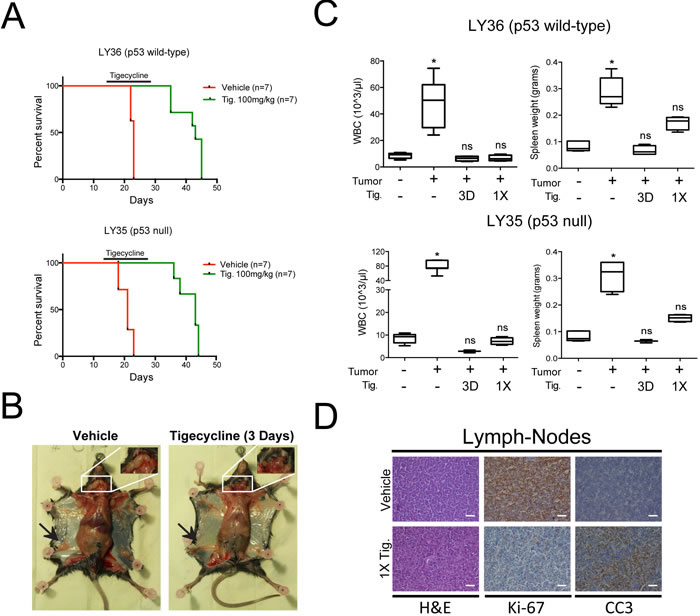 Inhibition of mitochondrial translation with Tigecycline provides a therapeutic window in a mouse model of Myc-induced lymphomas.