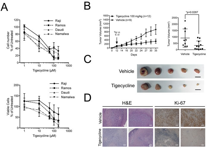 Tigecycline shows activity against human Burkitt&#x2019;s lymphoma xenografts.
