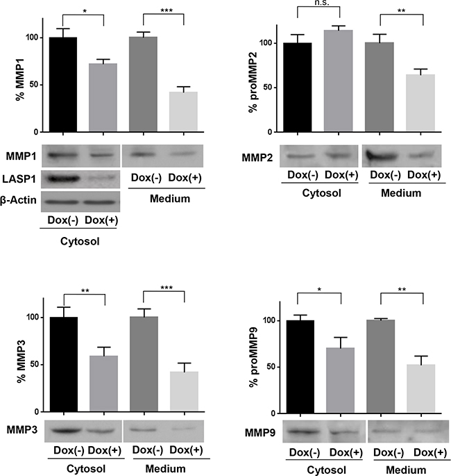 Loss of LASP1 impairs matrix metalloproteinases secretion by breast cancer cells.