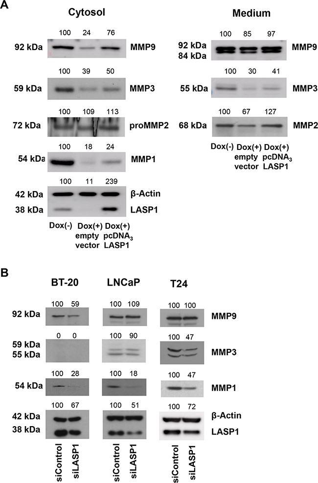 LASP1 rescue experiments and MMP expression in other tumor entities.