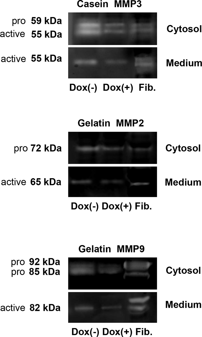 Gel zymography of cell lysate and conditional medium from MDA-MB-231-shLASP1 cells.