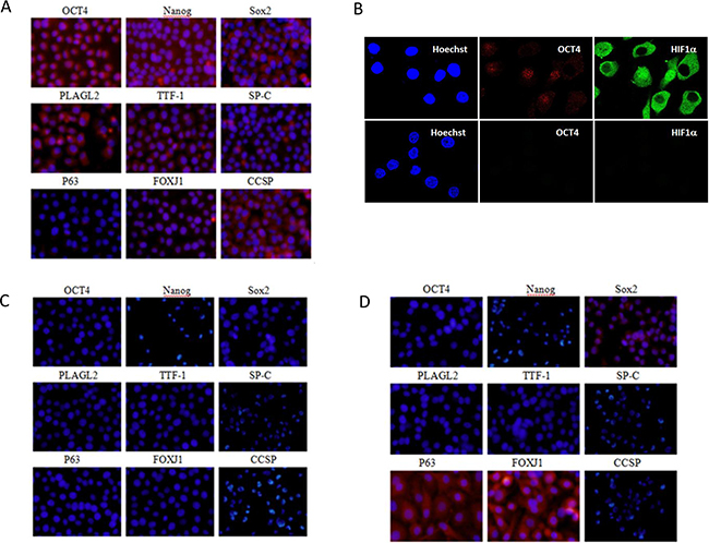 Immunofluorescent staining images of LACSC marker expression before and after each stage of differentiation.