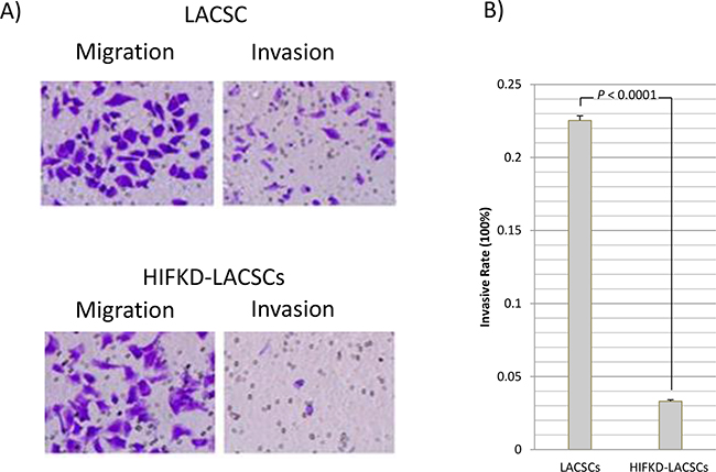 Migration and invasion activities of LACSCs and HIF1&#x03B1;-KD cells.