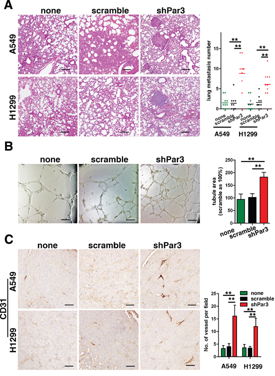 Loss of Par3 promotes LuAC tumor metastasis and angiogenesis.